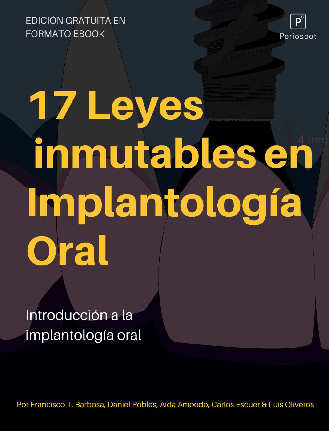 Las 17 Leyes Inmutables en Implantología Oral