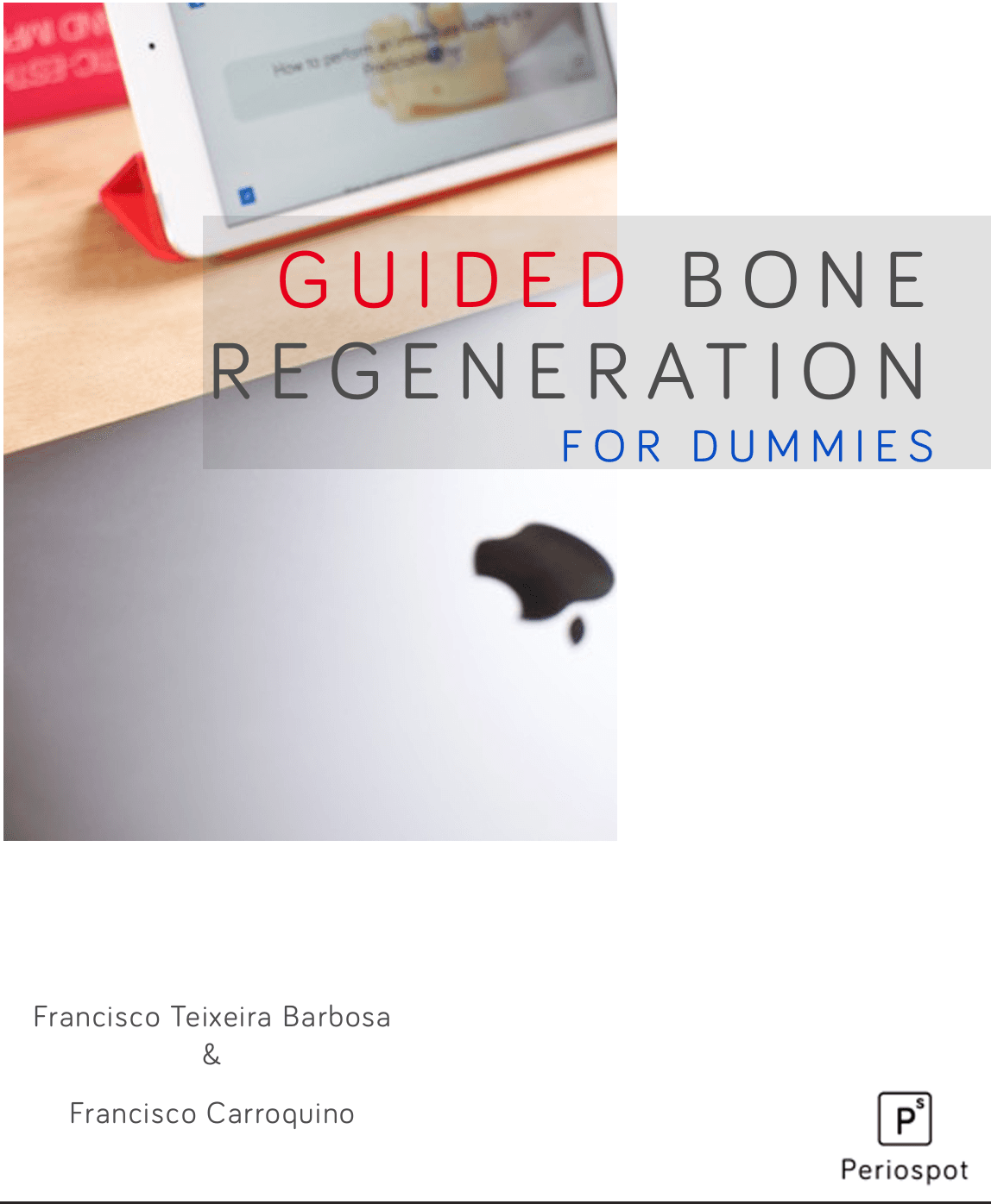 Guided Bone Regeneration In Implant Dentistry