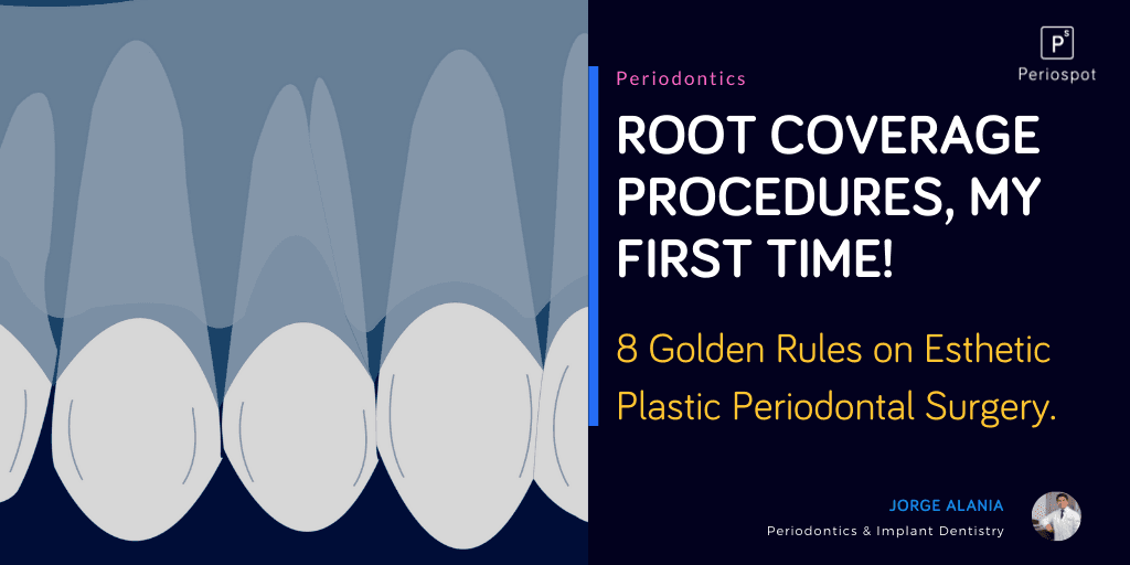 Root Coverage Procedures, My First Time! 8 Golden Rules on Esthetic Plastic Periodontal Surgery.