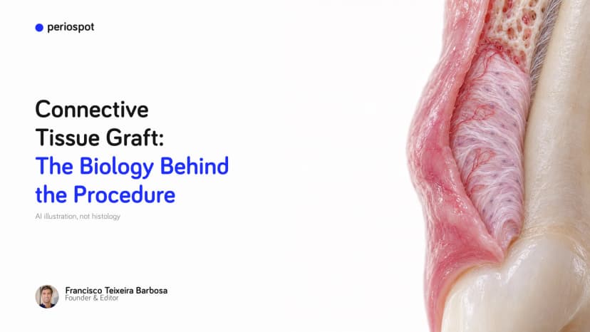 Connective Tissue Graft: The Biology Behind the Procedure
