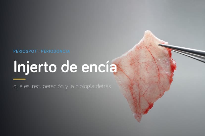 Injerto de Encía: qué es, tipos, recuperación y la biología detrás