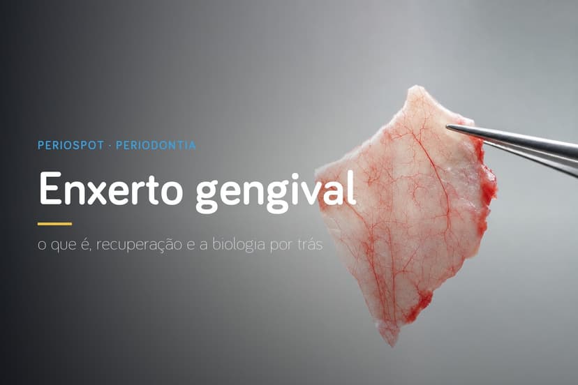 Enxerto Gengival: o que é, tipos, recuperação e a biologia por trás
