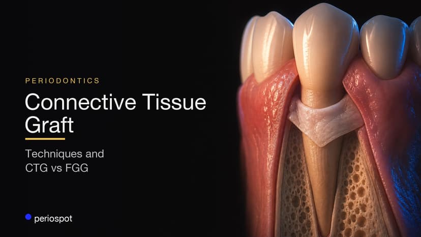 The Connective Tissue Graft: Harvesting Techniques, Indications, and CTG vs FGG