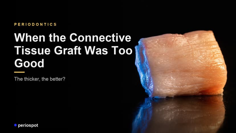 When the Connective Tissue Graft Was Too Good