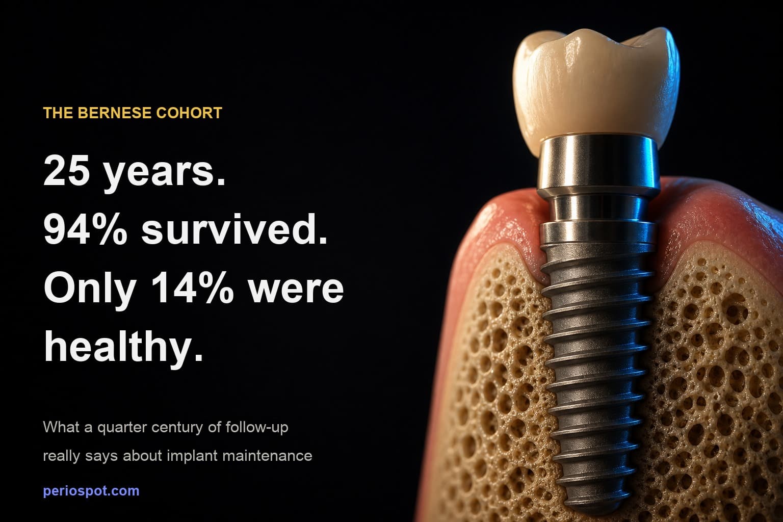 25 years of implant follow-up: 94 percent survived, 14 percent were healthy
