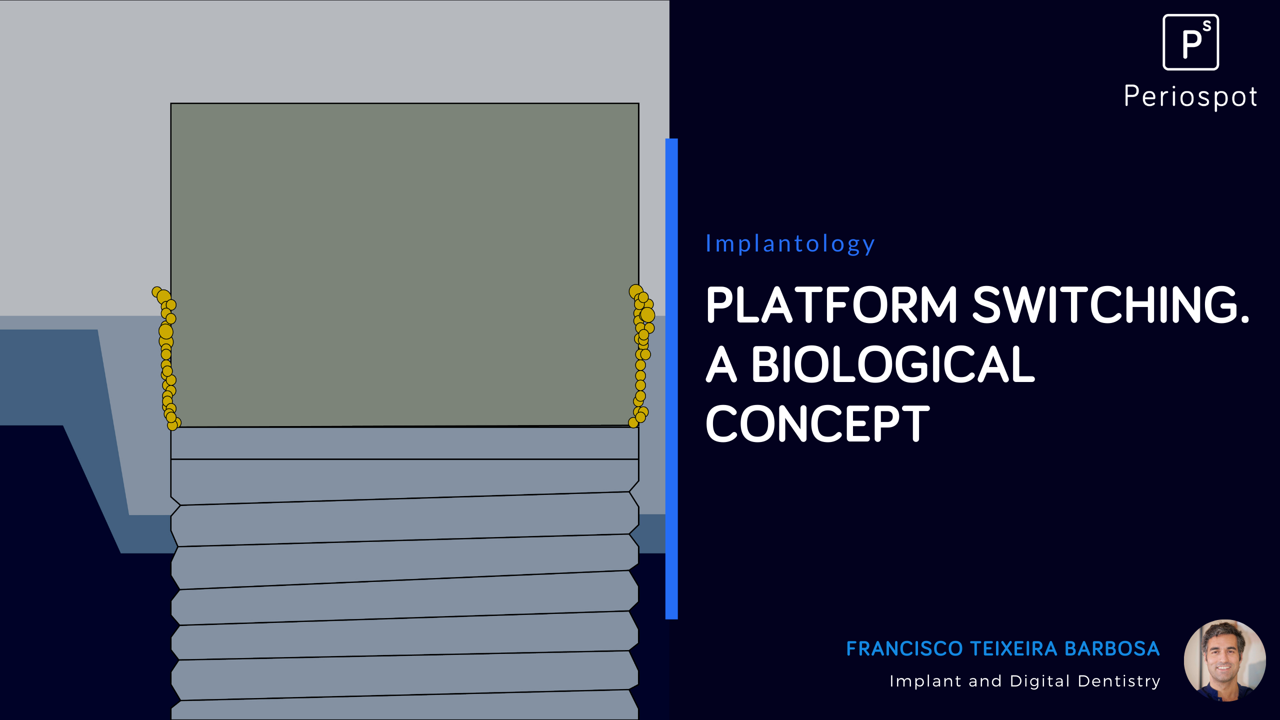 Platform Switching. A Biological Concept | Periospot