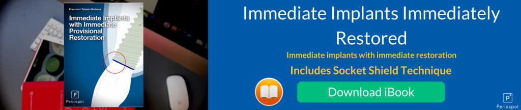 Immediate Implants Immediately restored. Socket Shield iBook.