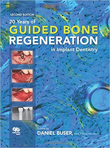 guided bone regeneration and Implant dentistry books