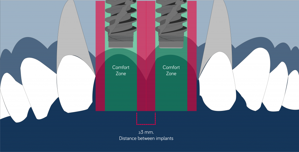 mesiodistal position inter implant