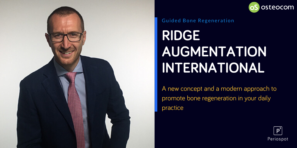 Ridge Augmentation International de stavola