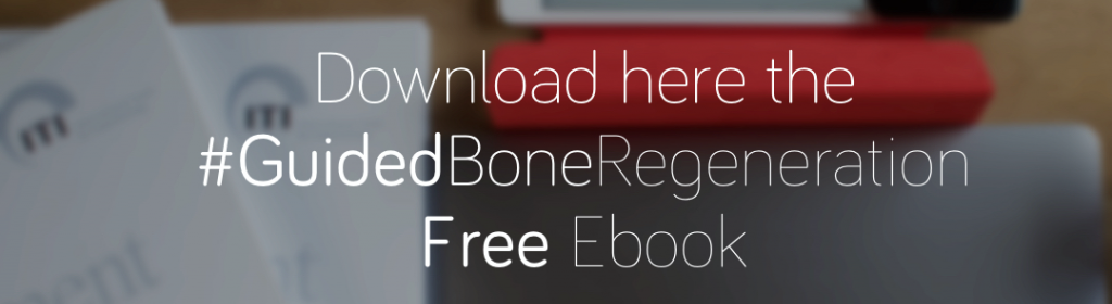 Guided Bone regeneration ebook