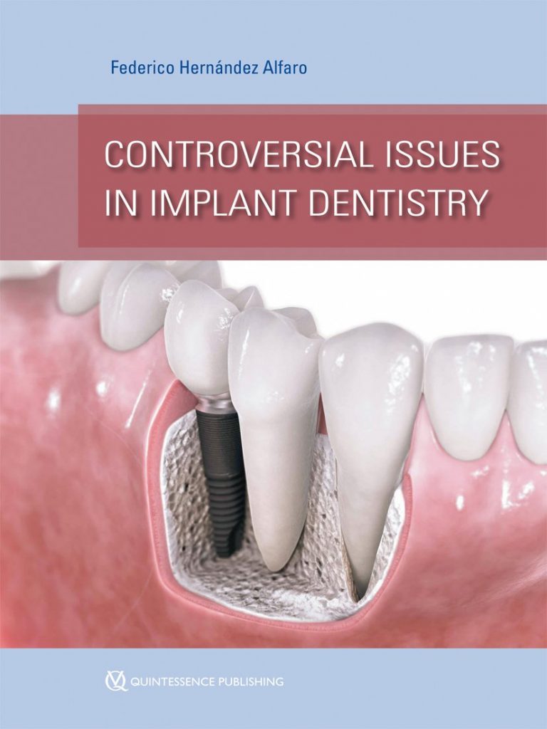 controversial issues in implant dentistry 