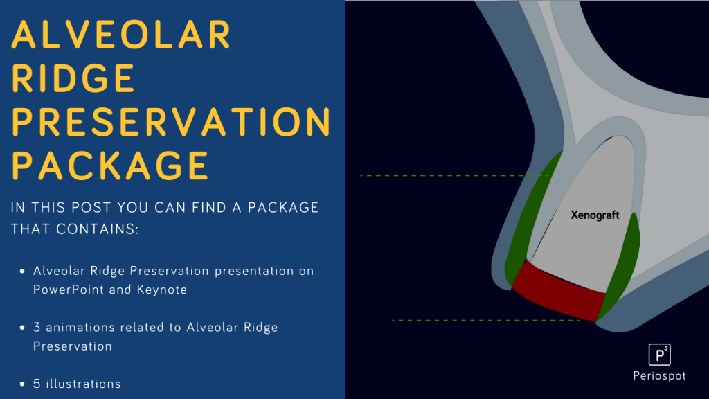 Alveolar Ridge Preservation Package - Periospot