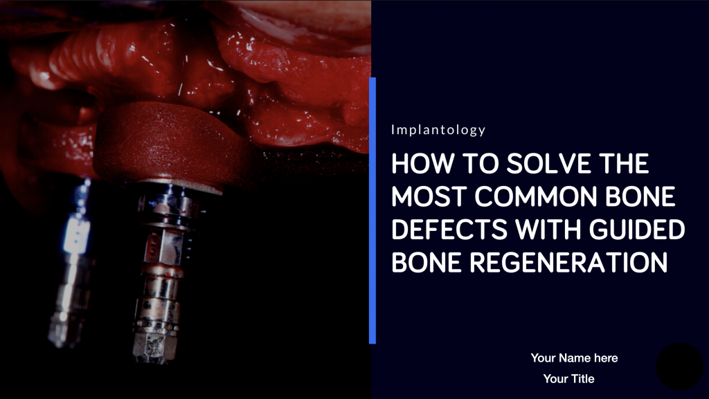 Guided Boner Regeneration presentation