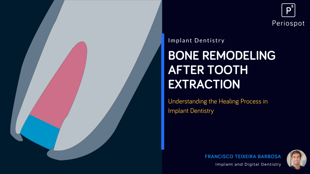 Understanding the Healing Process in Implant Dentistry